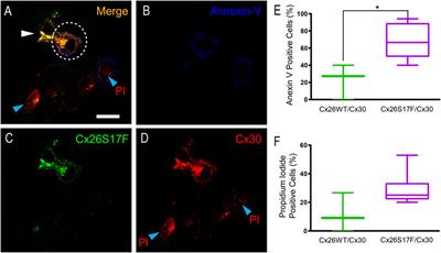 Expression of KID syndromic mutation Cx26S17F produces hyperactive hemichannels in supporting cells of the organ of Corti